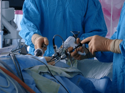 Interwencja chirurgiczna